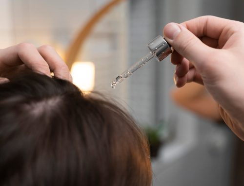 Should I take tablets, use a lotion or have injections? Which is the best treatment for my hair?