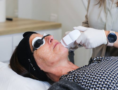 Post-IPL Care: what to do to reduce redness and help your skin recover as quickly as possible