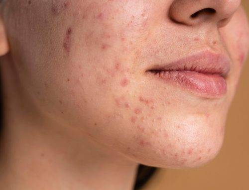 Myo-inositol: what the scientific evidence says and the cases in which it can help